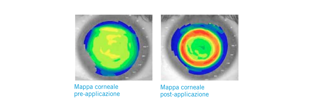 esavision-mappa-corneale